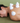 Body Cupping Kit